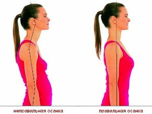 Правильная и неправильная осанка