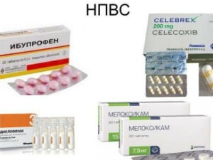НПВС