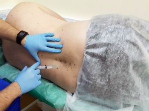 Блокада позвоночника
