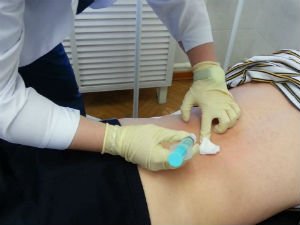 Блокада позвоночника